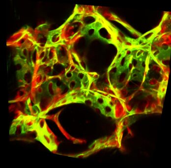 Fluorescence microscopy image of the lung. Lung endothelial cells are shown in green fluorescence and other lung cells in red fluorescence. (Image: Jalees Rehman)
                  