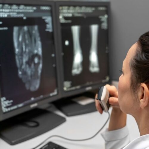 A woman looks closely at x-rays on a computer scren